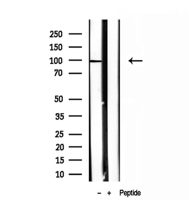 NSUN2 Antibody in Western Blot (WB)