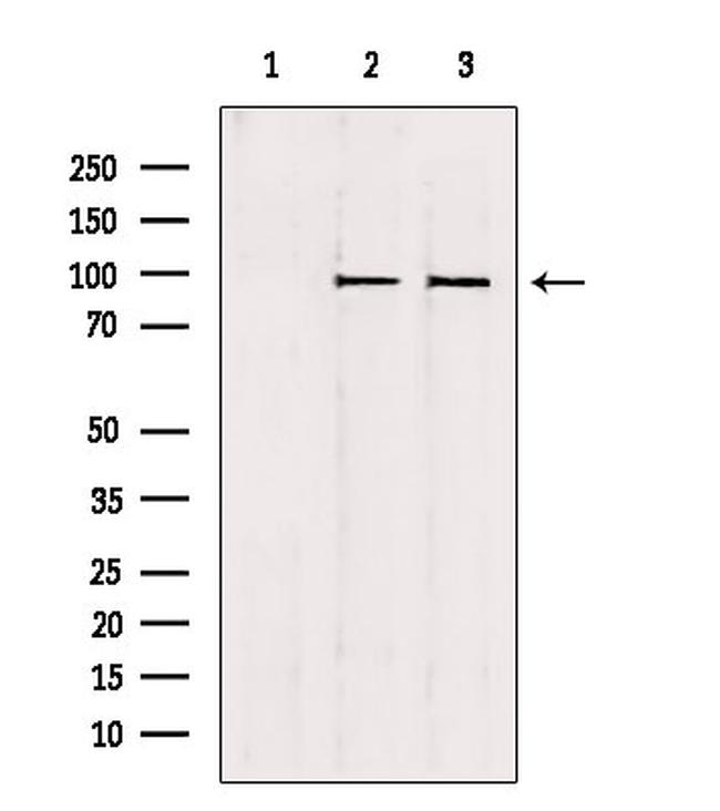 NSUN2 Antibody in Western Blot (WB)