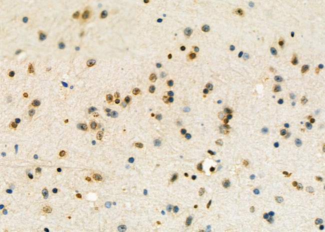 Nucleolin Antibody in Immunohistochemistry (Paraffin) (IHC (P))