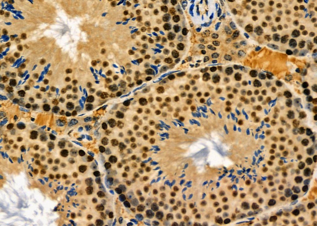 Nucleolin Antibody in Immunohistochemistry (Paraffin) (IHC (P))