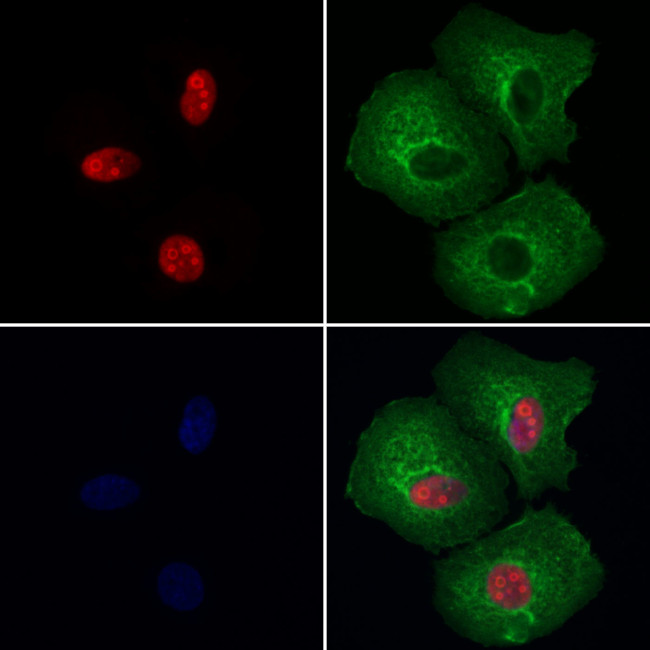 Nucleolin Antibody in Immunocytochemistry (ICC/IF)