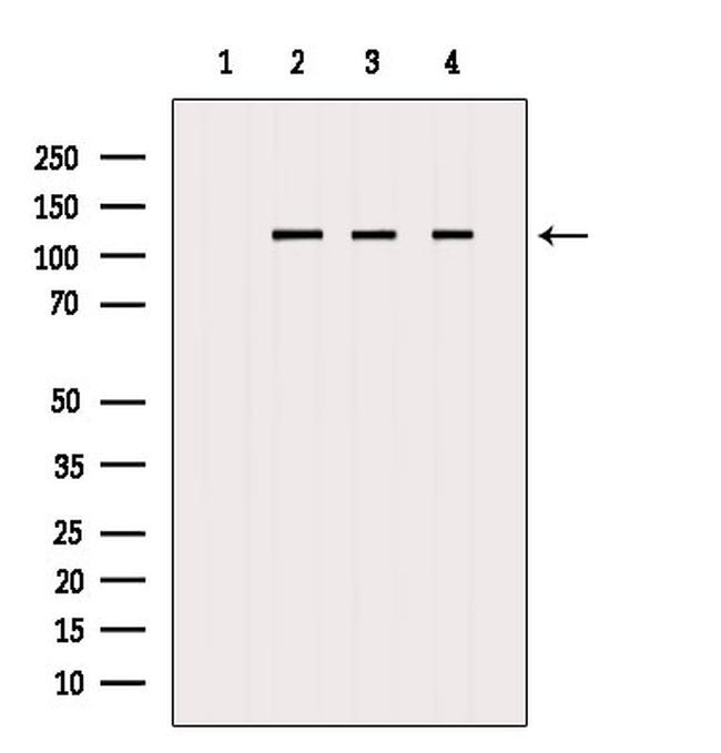 Nucleolin Antibody in Western Blot (WB)