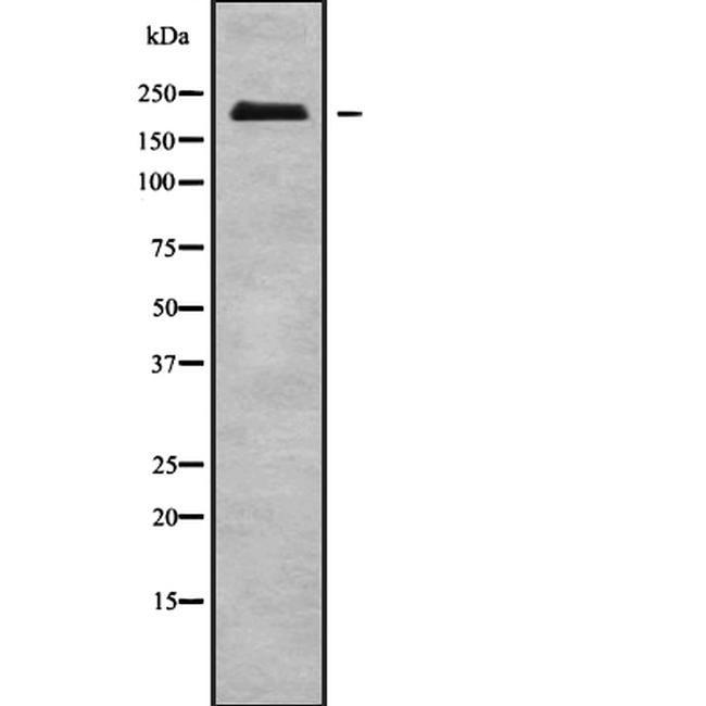 NUP210L Antibody in Western Blot (WB)