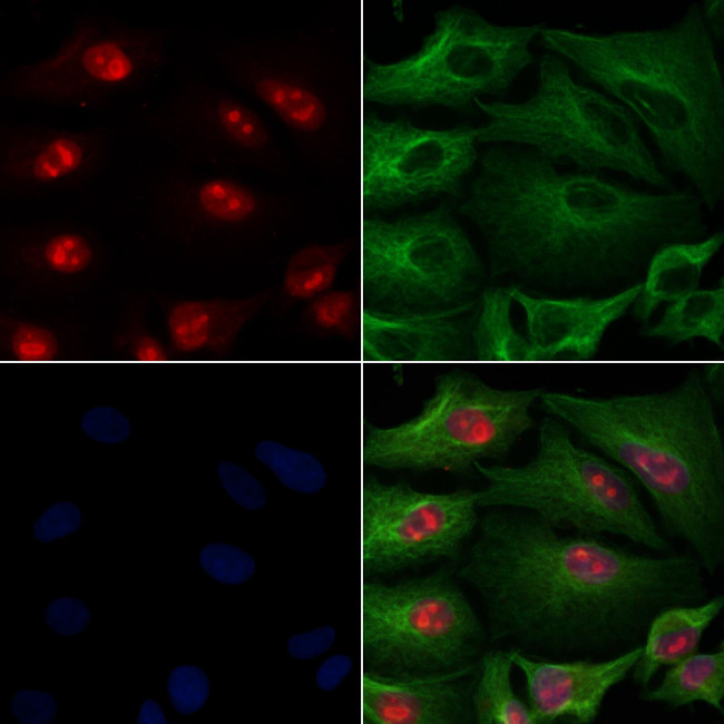 NUP98 Antibody in Immunocytochemistry (ICC/IF)