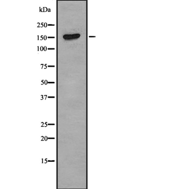 NUP98 Antibody in Western Blot (WB)