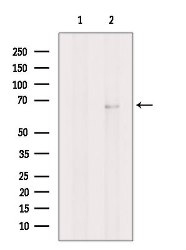 Nurr1 Antibody in Western Blot (WB)