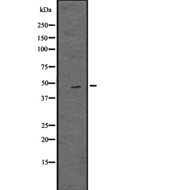 OAS1 Antibody in Western Blot (WB)