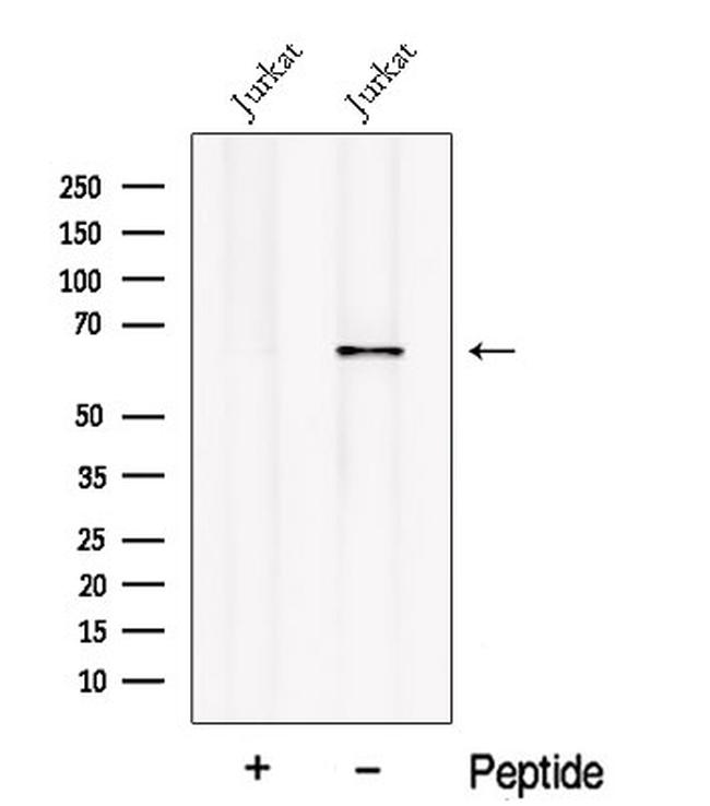 OAS2 Antibody in Western Blot (WB)