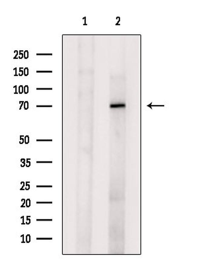 OAS2 Antibody in Western Blot (WB)