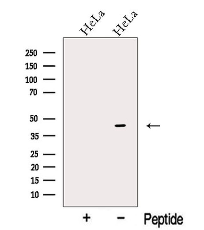 OFD1 Antibody in Western Blot (WB)