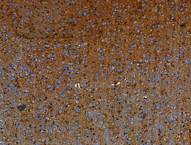 OLFM4 Antibody in Immunohistochemistry (Paraffin) (IHC (P))