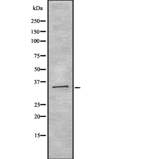 OLIG1 Antibody in Western Blot (WB)