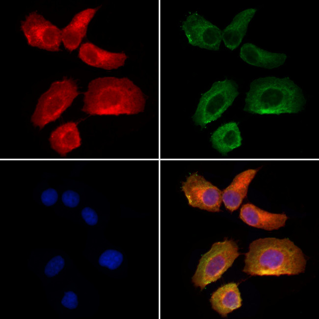 Optineurin Antibody in Immunocytochemistry (ICC/IF)