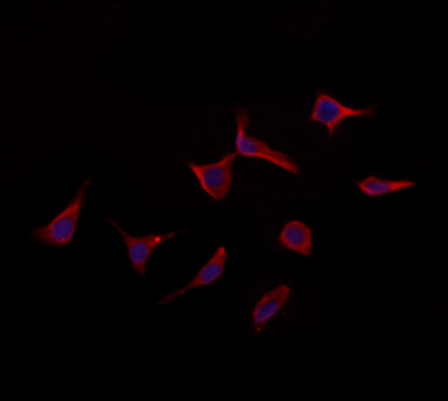 OSBP Antibody in Immunocytochemistry (ICC/IF)