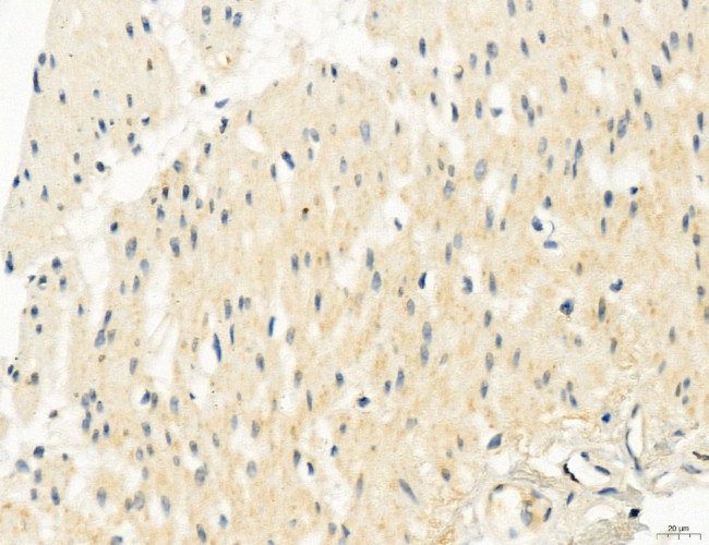 OSBP Antibody in Immunohistochemistry (Paraffin) (IHC (P))