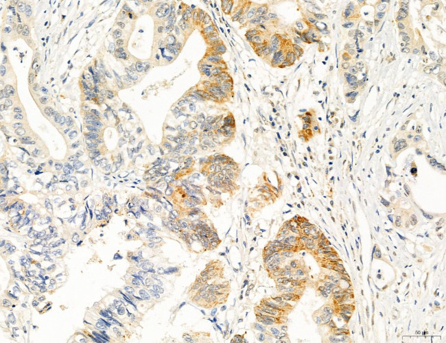 OSBP Antibody in Immunohistochemistry (Paraffin) (IHC (P))