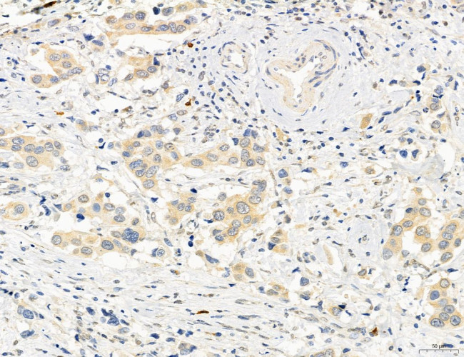 OSBP Antibody in Immunohistochemistry (Paraffin) (IHC (P))