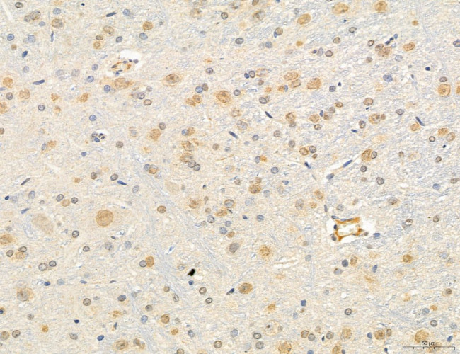 OSBP Antibody in Immunohistochemistry (Paraffin) (IHC (P))