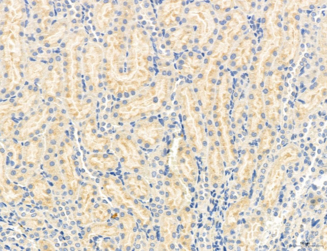 OSBP Antibody in Immunohistochemistry (Paraffin) (IHC (P))