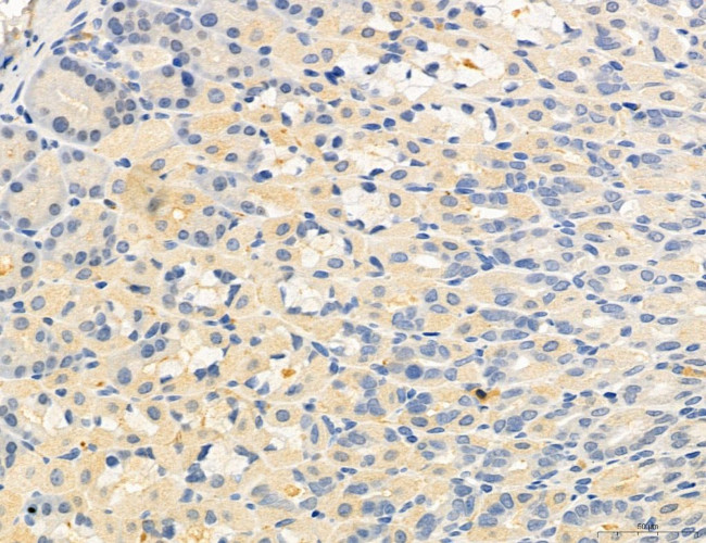 OSBP Antibody in Immunohistochemistry (Paraffin) (IHC (P))