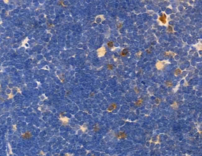 OSBP Antibody in Immunohistochemistry (Paraffin) (IHC (P))