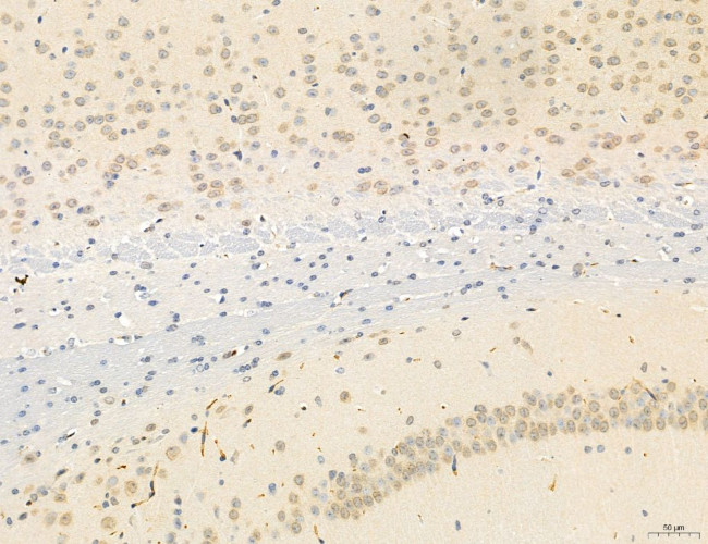 OSBP Antibody in Immunohistochemistry (Paraffin) (IHC (P))