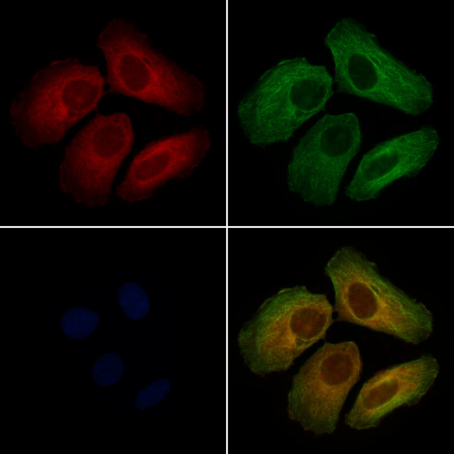 ORP2 Antibody in Immunocytochemistry (ICC/IF)