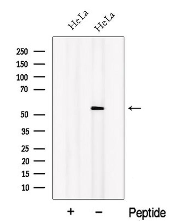 ORP2 Antibody in Western Blot (WB)