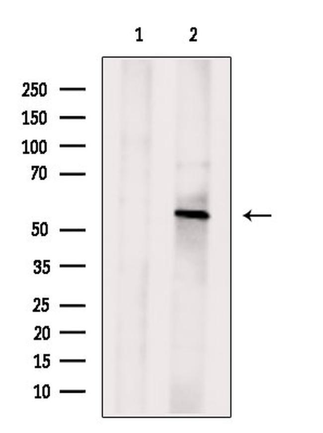 ORP2 Antibody in Western Blot (WB)