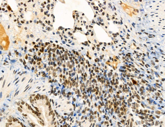 SP7 Antibody in Immunohistochemistry (Paraffin) (IHC (P))