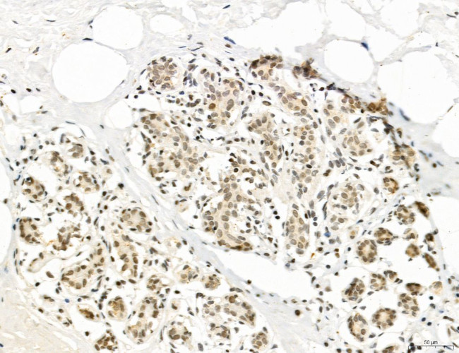 SP7 Antibody in Immunohistochemistry (Paraffin) (IHC (P))