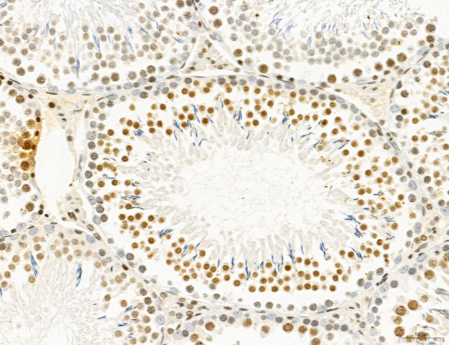 SP7 Antibody in Immunohistochemistry (Paraffin) (IHC (P))