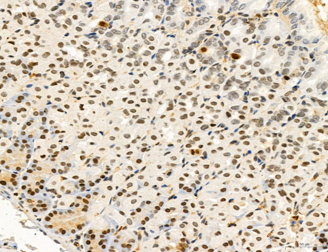 SP7 Antibody in Immunohistochemistry (Paraffin) (IHC (P))