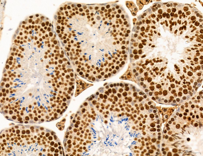 SP7 Antibody in Immunohistochemistry (Paraffin) (IHC (P))