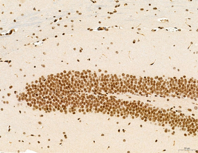 SP7 Antibody in Immunohistochemistry (Paraffin) (IHC (P))