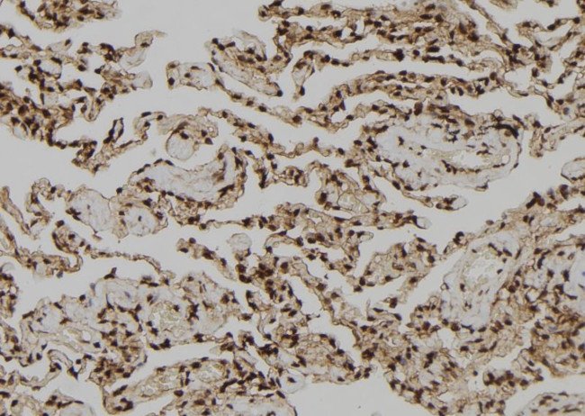 OTUB1 Antibody in Immunohistochemistry (Paraffin) (IHC (P))