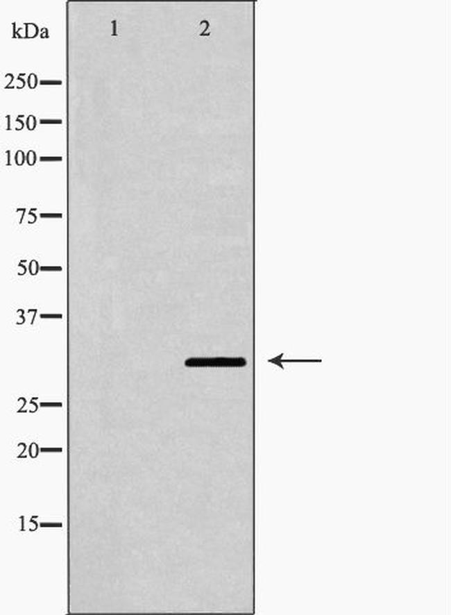 OTX2 Antibody in Western Blot (WB)