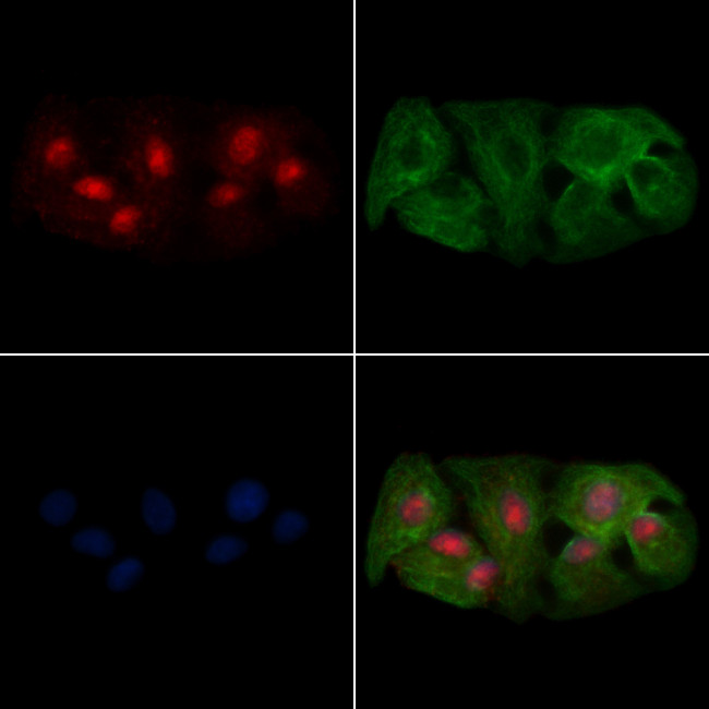 OVOL2 Antibody in Immunocytochemistry (ICC/IF)