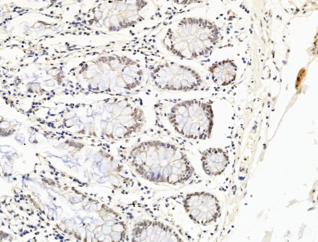 OVOL2 Antibody in Immunohistochemistry (Paraffin) (IHC (P))