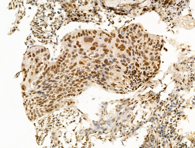 OVOL2 Antibody in Immunohistochemistry (Paraffin) (IHC (P))