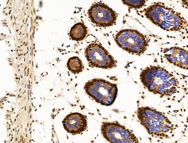 OVOL2 Antibody in Immunohistochemistry (Paraffin) (IHC (P))