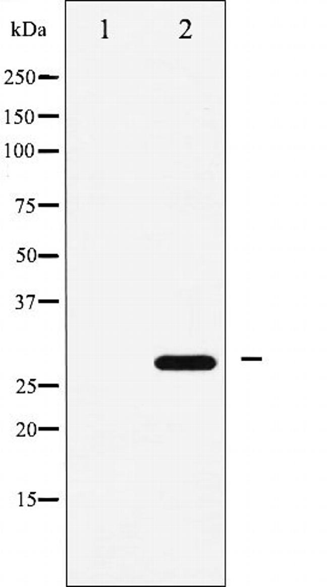 p27 Kip1 Antibody in Western Blot (WB)