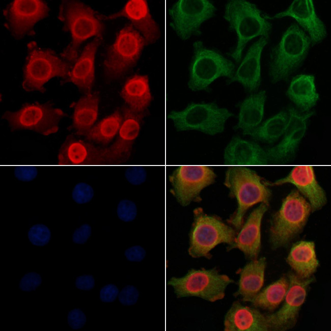 p27 Kip1 Antibody in Immunocytochemistry (ICC/IF)