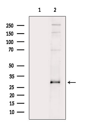 p27 Kip1 Antibody in Western Blot (WB)