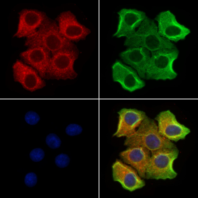 P2X3 Antibody in Immunocytochemistry (ICC/IF)