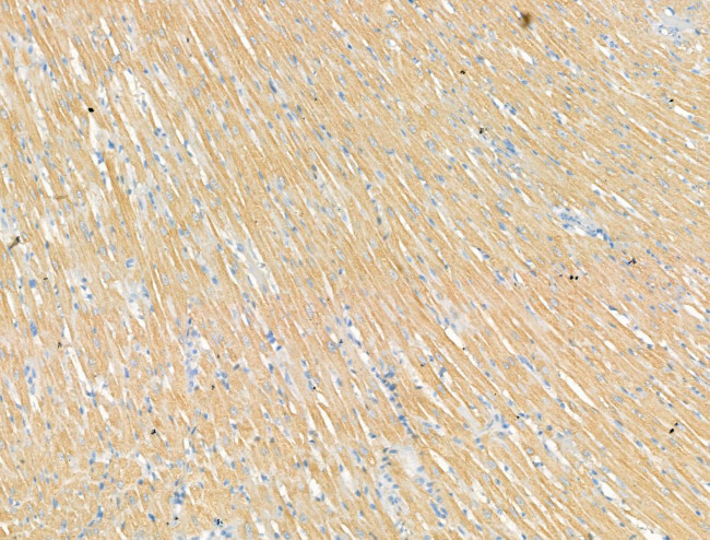 P2X3 Antibody in Immunohistochemistry (Paraffin) (IHC (P))