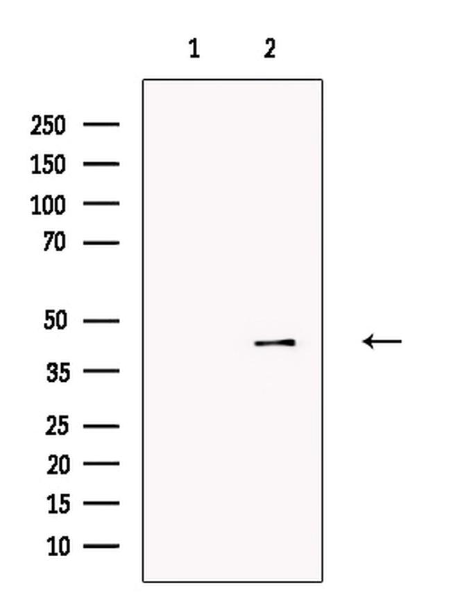 P2X3 Antibody in Western Blot (WB)