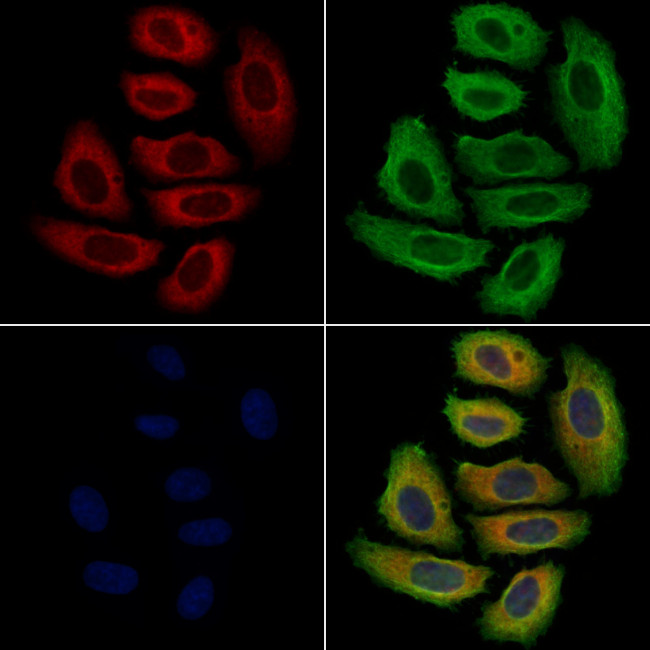 p40 Antibody in Immunocytochemistry (ICC/IF)