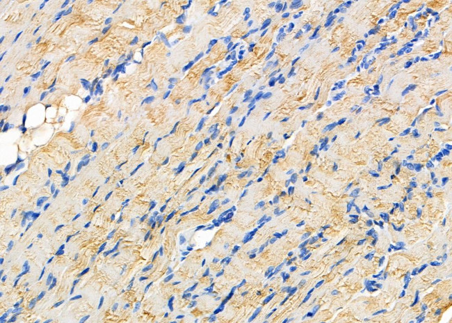 P4HTM Antibody in Immunohistochemistry (Paraffin) (IHC (P))