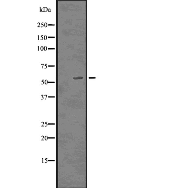 p57 Kip2 Antibody in Western Blot (WB)